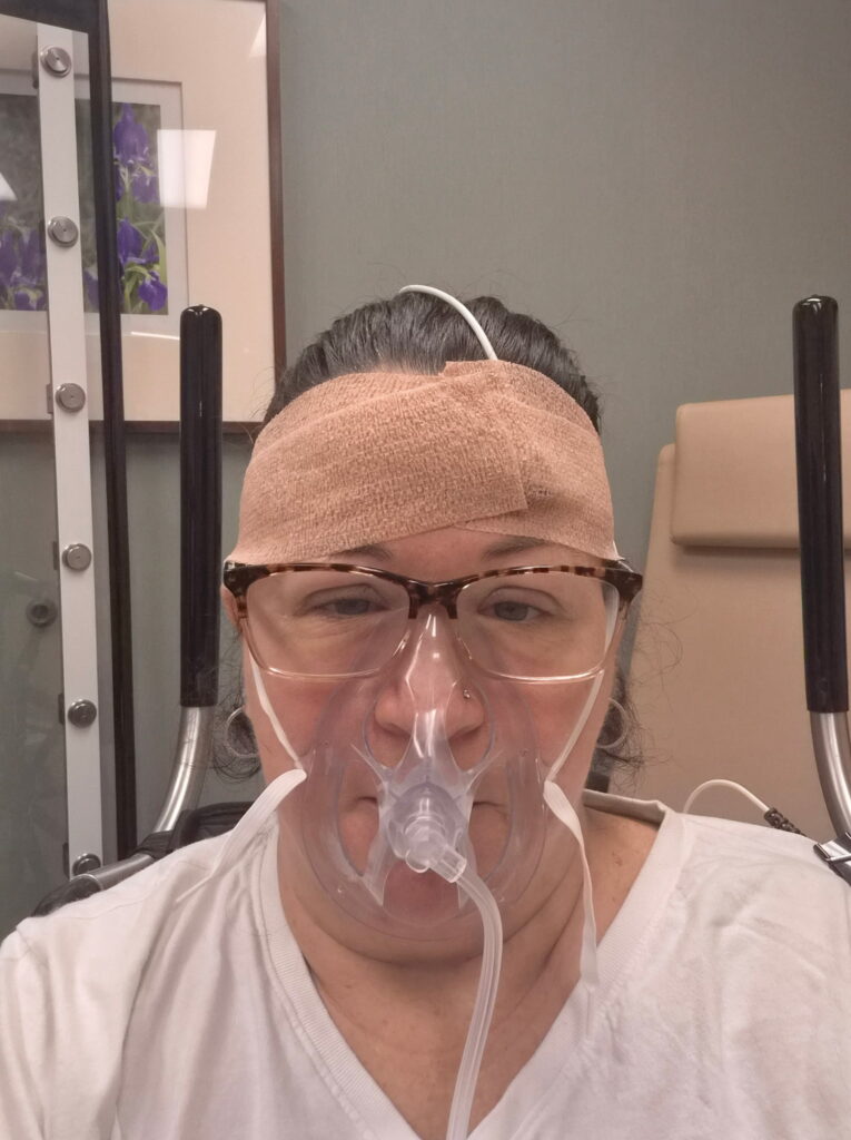 A person wearing glasses sits in a medical setting, with a bandage on their forehead and an oxygen mask over their nose and mouth They are wearing a white shirt and looking directly at the camera